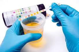 Urinalysis